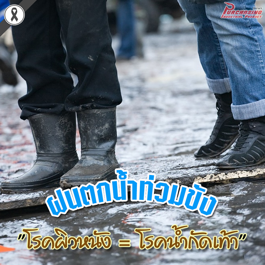 ฝนตกน้ำท่วมขังแบบนี้ระวังโรคผิวหนัง - โรคน้ำกัดเท้า กันด้วย?